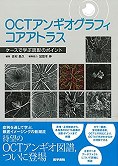OCTアンギオグラフィコアアトラス: ケースで学ぶ読影のポイント　医学書院