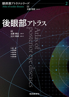 眼疾患アトラスシリーズ　第2巻　後眼部アトラス　　総合医学社／2019年10月発行