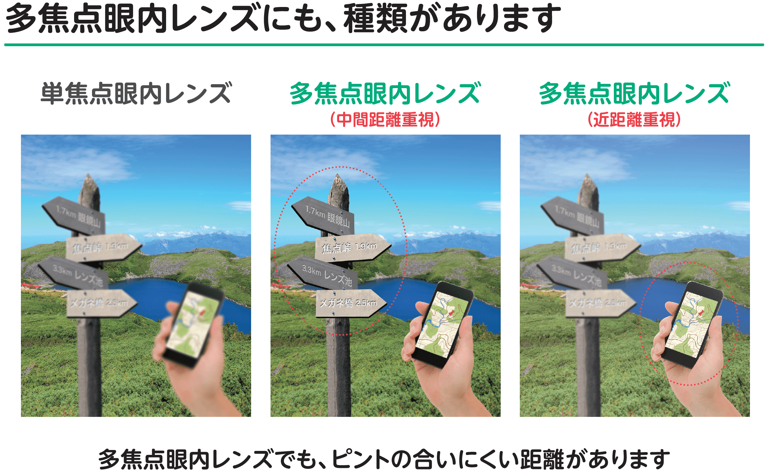 多焦点眼内レンズにも種類があります